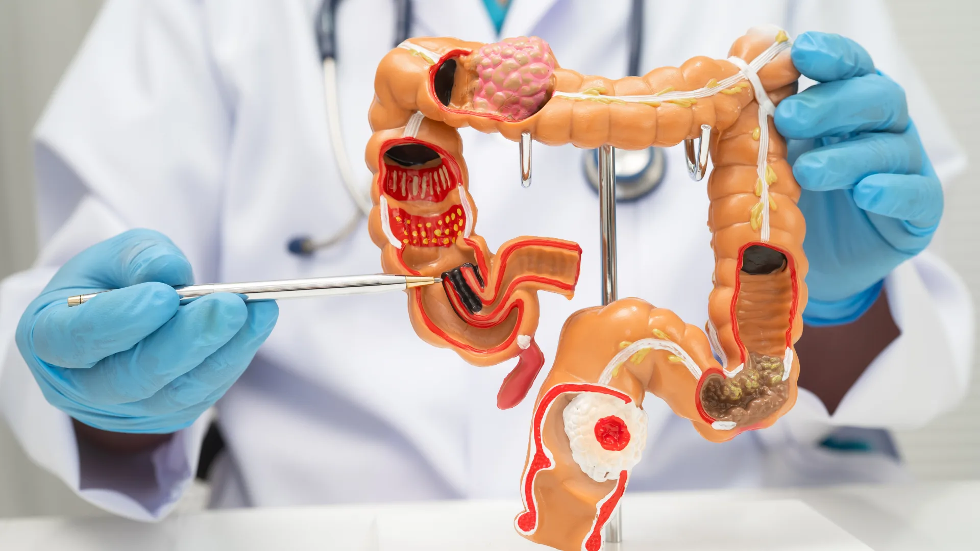 Gastroenterologista